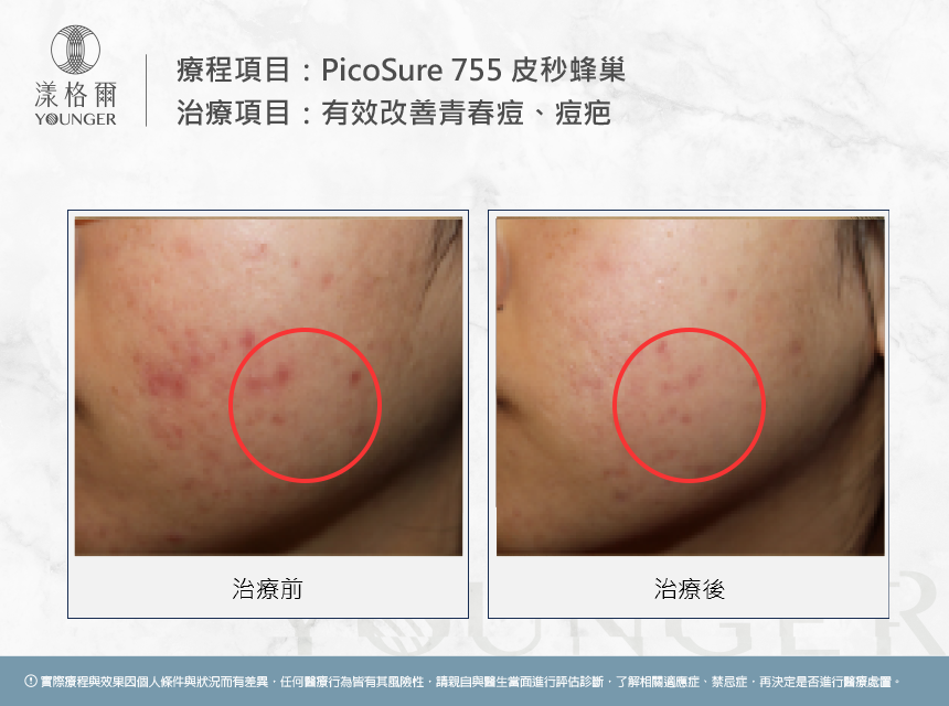 介紹5